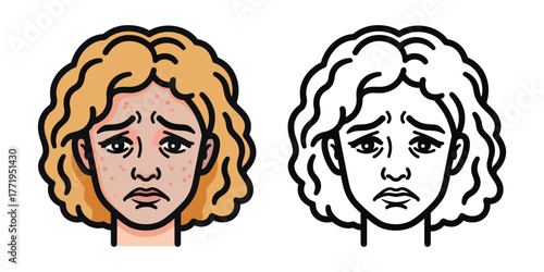 Cartoon woman with acne and sad expression next to outline version face pimples