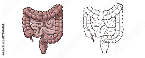 Medical illustration showing large and small human intestines in two styles: a colored version and a black and white line art outline