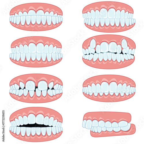 Illustration mouth teeth bite oral healthcare shape of tooth set