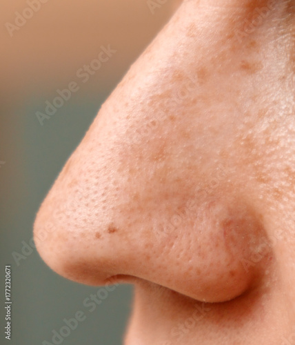 Foto A woman's nose has a small bump on it