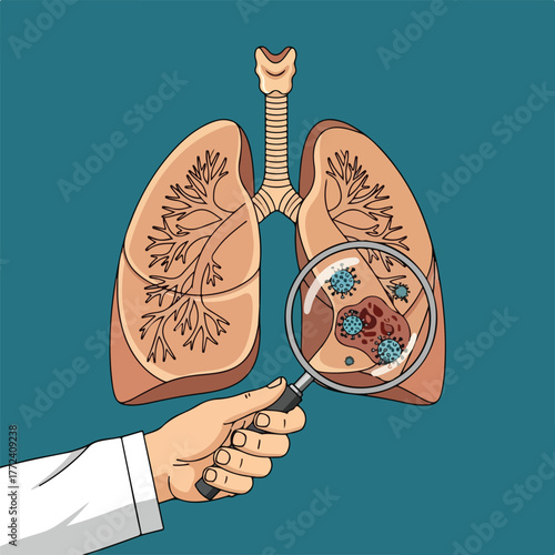 Doctor examining lungs with magnifying glass showing virus