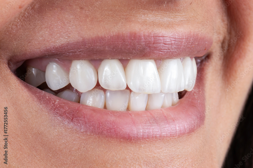 Obraz premium ceramic crowns and veneers