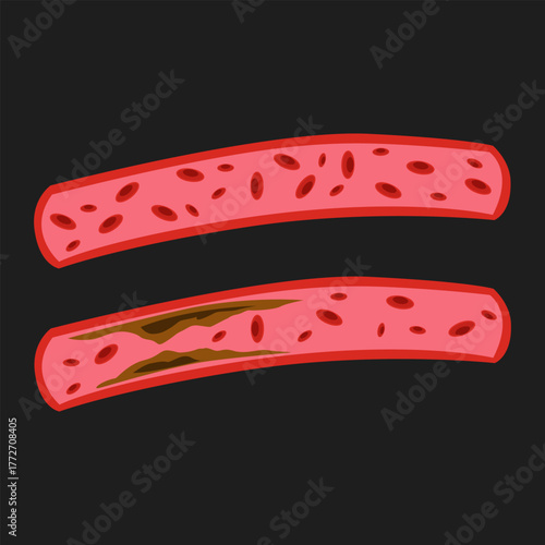 Blood clot illustration art sign icon design vector