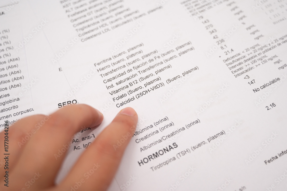 Obraz premium Finger pointing at blood test results, showing cholesterol levels on a Spanish medical report