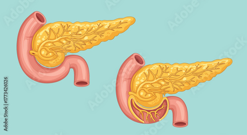 Illustration showing the anatomy of the human pancreas and duodenum.
