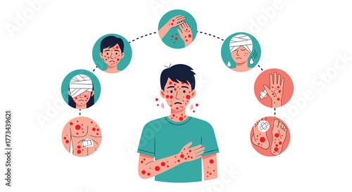 Illustration of a man suffering from a widespread skin rash, highlighting various affected body parts and related symptoms.