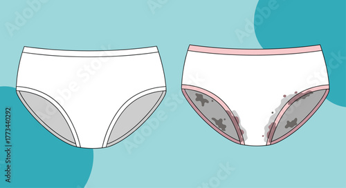 Graphic depicting a pair of clean white underwear next to one with visible menstrual blood stains.