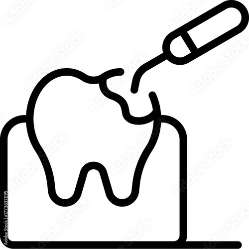 Dental sealant being applied on molar tooth surface, protecting enamel from bacteria and cavities