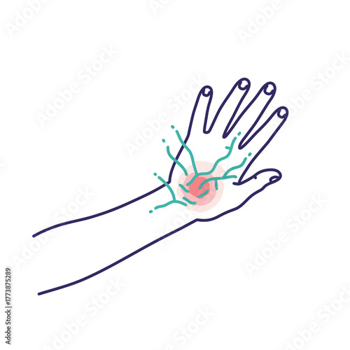 A minimalist illustration depicts a human hand experiencing localized pain and inflammation, with radiating lines symbolizing nerve discomfort or medical issues.