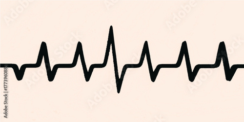 Electrocardiogram (ECG) showing a continuous heartbeat wave or pulse graph on a medical monitor for health monitoring
