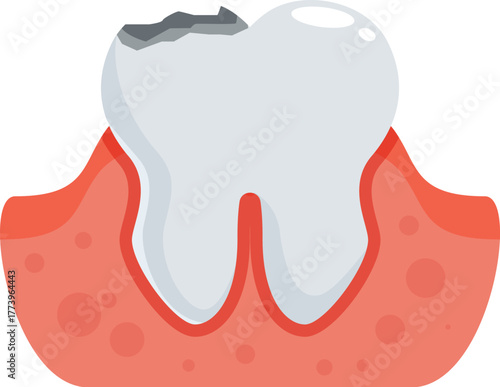 Cartoon illustration of a damaged tooth with gingivitis, emphasizing the importance of dental hygiene and treatment