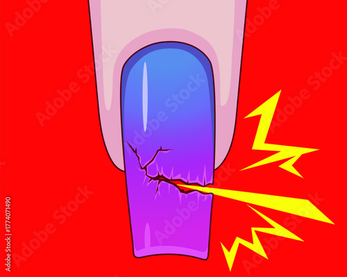 Broken nail. Healthcare illustration. Vector illustration.