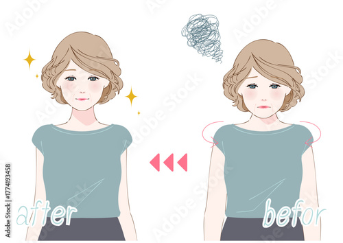姿勢改善ビフォーアフター中高年女性上半身