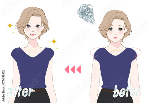 姿勢改善ビフォーアフター女性バストアップ