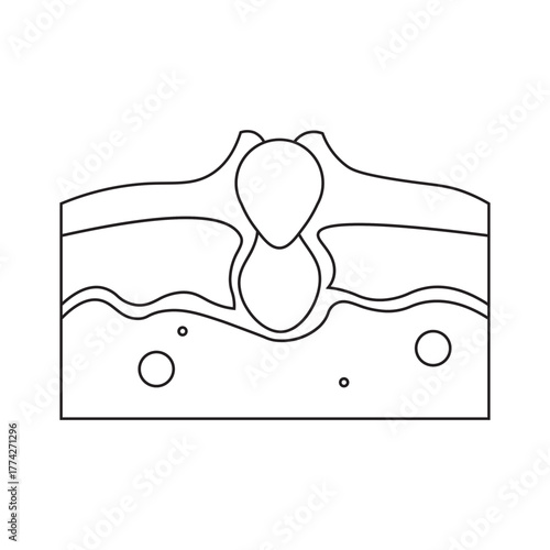 Acne Skin Cross Section line icon