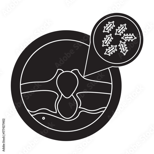 Cutibacterium acnes on Human Skin glyph icon