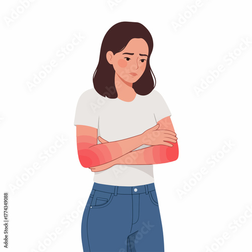 Flat Illustration Woman with Elbow Pain and Redness Medical Illustration