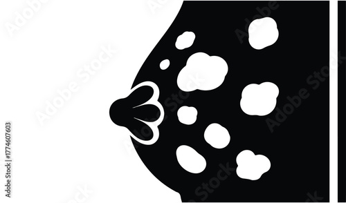 Stylized illustration of a breast with multiple white spots representing potential abnormalities