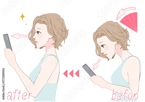 スマホ首改善女性の横顔ビフォーアフター
