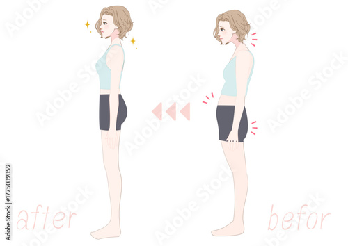 猫背から美姿勢へ女性の横向きビフォーアフター