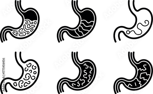 Diagram illustrating different stages of digestion within the stomach.