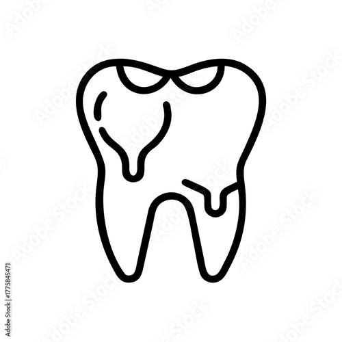 An illustrative depiction of a decayed tooth