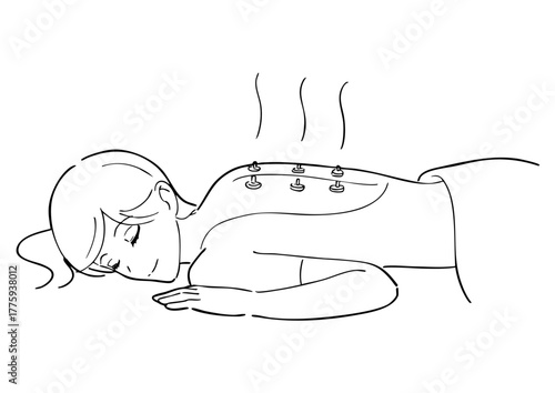 背中にお灸をする女性の白黒イラスト