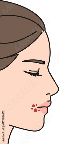 vector illustration of woman with rickets