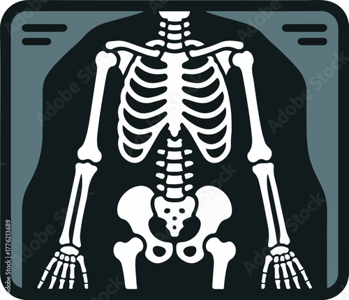 Human skeleton X-ray vector graphic on a dark background showing bones of the torso pelvis and limbs