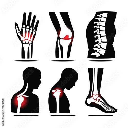 Anatomical illustrations of joint pain and skeletal system issues