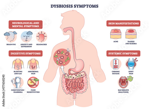 Dysbiosis symptoms visual shows gut imbalance across body, human silhouette with intestines and bacteria icons highlights digestive, skin, mental signs. Outline diagram