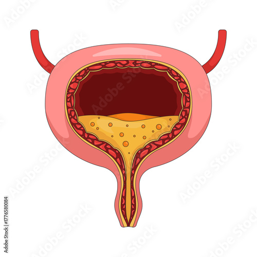 Human urinary bladder cross-section with urine 2D vector illustration. Biology diagram. Medical reference. Internal organ function flat object isolated on white background. Colorful cartoon image
