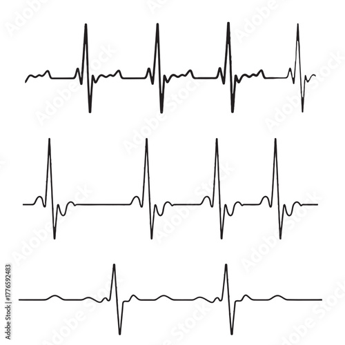 Electrocardiogram heart rhythm display health medical record