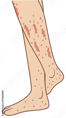 Closeup of legs with visible skin irritation and red spots  