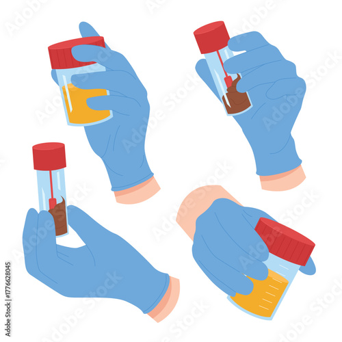 Laboratory analysis of urine and feces for medical clinical diagnosis. Doctors hands in blue latex gloves holding test tubes, containers with human excrements samples cartoon vector illustration