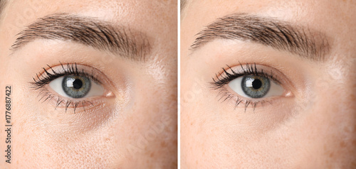 Fotografi Woman before and after anti-aging treatment, closeup
