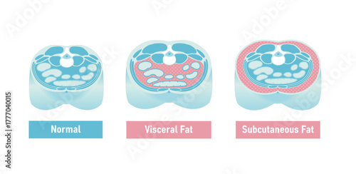 Abdominal cross section illustration of subcutaneous fat and visceral fat