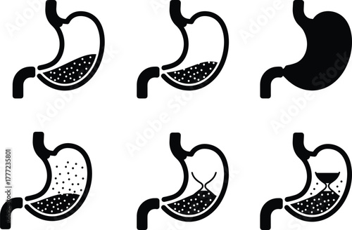 Human stomach anatomy illustration, digestive system medical diagram, gastric content stages, healthcare education sketch, biology organ drawing, monochrome vector set