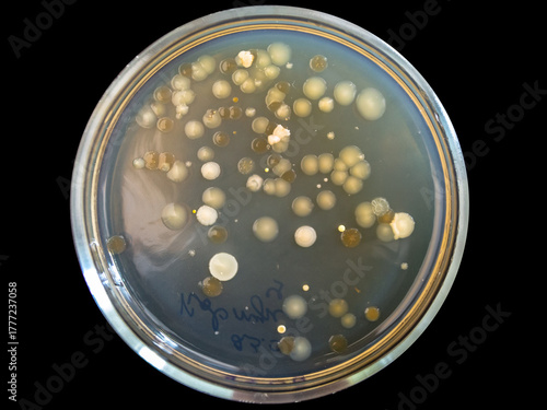 Obraz na plátně Petri dish with bacterial colonies on black background.