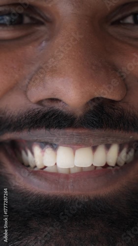 Vertical video. Close-up of a man's beaming face, displaying his sparkling white teeth following a successful dental cosmetic procedure, radiating the happiness of a bright and healthy smile