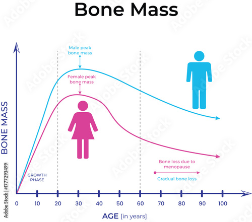 Age-Related Bone Mass Changes and Peak Bone Mass by Gender vector Illustaration