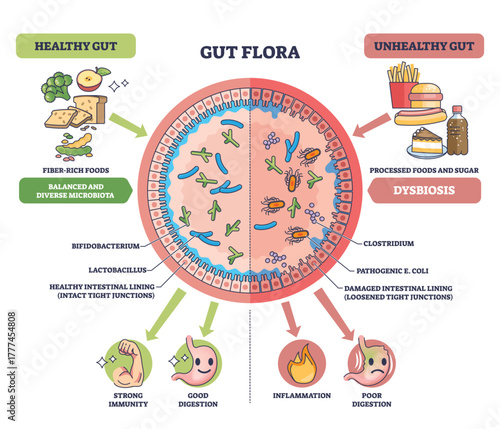 Gut flora diagram contrasting healthy vs unhealthy microbiota, central intestinal cross-section, bacteria, and food icons show balance versus dysbiosis. Outline diagram