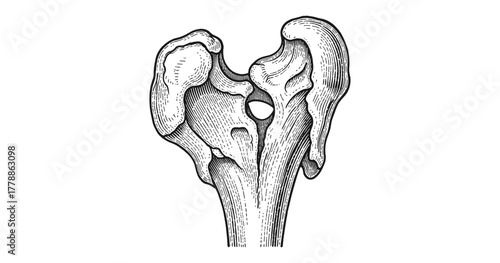 Vintage anatomical drawing of human hip joint: detailed black and white medical diagram