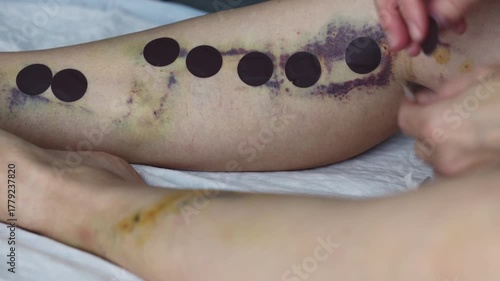 Woman applies the stick on bandage to cover the small cuts after operation.