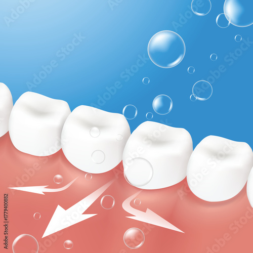 3D Realistic Vector of deep cleaning molar teeth. Plaque removal and gum care concept