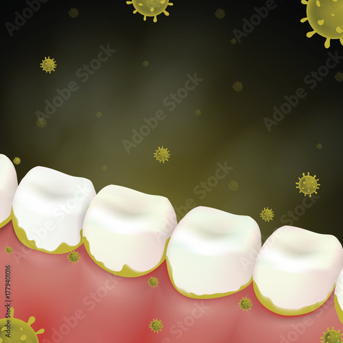 Realistic Vector of molar teeth with plaque and bacteria. Poor oral hygiene and gingivitis concept