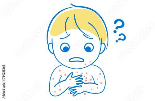 体に発疹　ブツブツができて困っている子供のイラスト