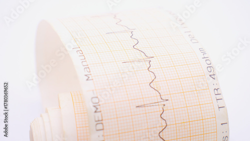 heart on the cardiogram