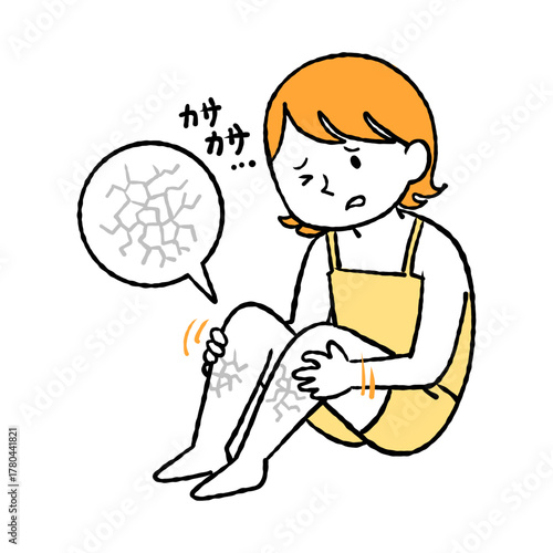 乾燥で足がカサカサする女性