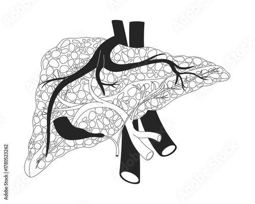 Human liver with cirrhosis and damaged nodular tissue outline illustration. Hepatic disease. Internal organ tumor. Fibrosis pathology 2D line object isolated on white. Monochrome vector linear image